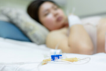 Fototapeta na wymiar Close up of a woman patient in hospital with saline intravenous