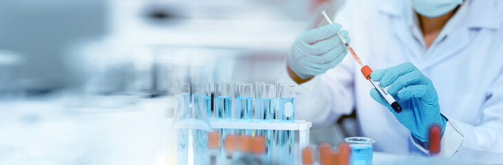 Chemists test and develop blood compatibility in humans medical laboratories. Modern medical...