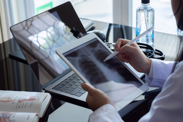 Doctor woman hand holding digital tablet with chest x-ray film (CXR ) on screen and work on laptop...