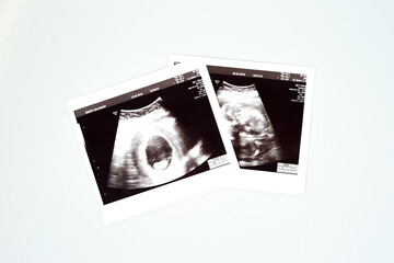 Result of ultrasound picture or ultrasonography for pregnancy on top of white isolated background