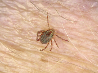 Tick on human hairy skin background. Ixodes ricinus or scapularis. Dangerous parasitic mite on blurry pink texture. Disgusting biting insect. Encephalitis infection. Tick-borne diseases 