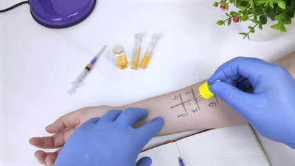 An allergist doctor in the laboratory conducts a prik allergy test. Skin test for household, food, epidermal allergic reactions