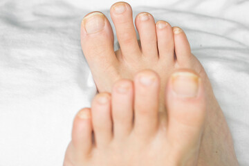 Obraz na płótnie Canvas Toenails on a woman's feet