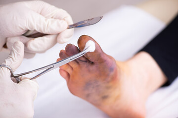Obraz na płótnie Canvas Finger injured woman visiting male doctor traumatologist