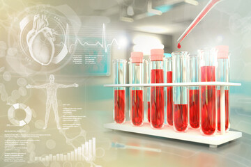 Medical 3D illustration, proofs vials in university facility - blood sample gene test for chloride or cholesterol with creative overlay