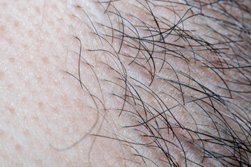 Close-up of male body hair and skin in soft focus with strong magnification under the microscope. Concept - stiff hair and healthcare