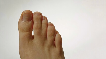 webbed toes