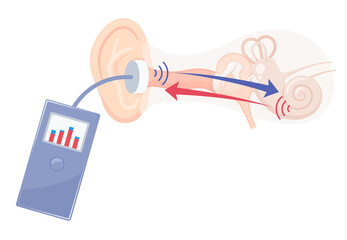 OAE_耳音響放射の仕組みのイラスト © ふわぷか