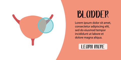 Human bladder diagnostics. Сystitis, bladder stones, cancer. Vector flat illustration. Perfect for banner, landing page, website