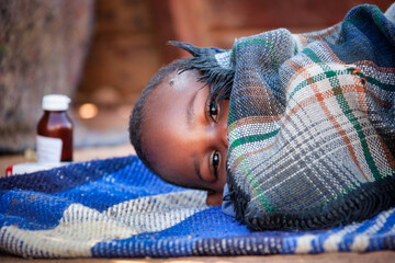 malaria sick kid