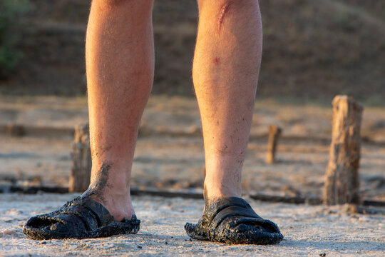 Bare feet in sandals, dirty feet with wounds, mud on his feet.