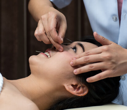 woman lying on a table in an alternative medicine spa having an acupuncture and reiki treatment done on her face by an acupucturist