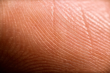 Detailed macro photo of human skin. Detailed texture. Closeup background