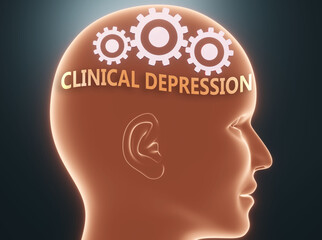 Clinical depression inside human mind - pictured as word Clinical depression inside a head with cogwheels to symbolize that Clinical depression is what people may think about, 3d illustration