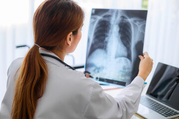 Asian young female doctor examining chest x-ray film of patient at hospital. Health and medical...