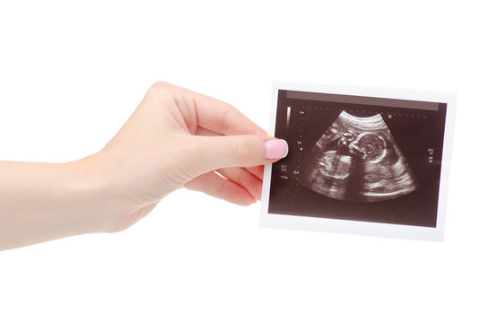 Woman holding ultrasound film close up, isolated on white background.