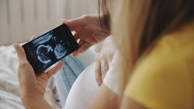 Happiness of motherhood, two women looking at ultrasound image of future baby on smartphone. Homosexual pregnant lesbian couple. IVF maternity, LGBT Pride Month, relationship, childbirth, concept.
