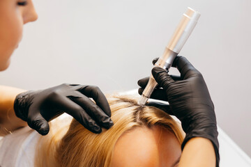 Young blonde woman with hair loss problem receiving injection, close up