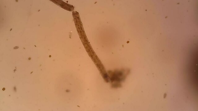 Microscope Zooplankton Freshwater Pond Harpacticoida 1000x