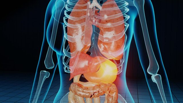 Failing and injured stomach in 3D render animation. Cancer, tumor tissue problem, metastasis and healthcare issue. Medical medicine science, human anatomy, gastrointestinal injury