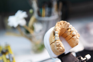 Dental technician. Restoration of teeth.