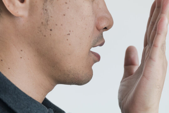 Closeup Of Asian Young Man Has Bad Breath With Concept
