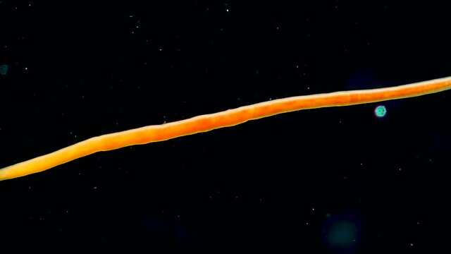 Oligochaeta, Turbellaria in the Black Sea