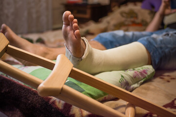Gypsum is imposed on the man’s leg and walking on crutches is prescribed, and bed rest, as he has...