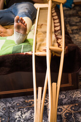 Gypsum is imposed on the man’s leg and walking on crutches is prescribed, and bed rest, as he has a closed fracture of the fibula without displacement.