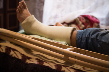 Gypsum is imposed on the man’s leg and walking on crutches is prescribed, and bed rest, as he has...