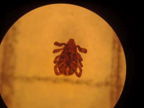 A tick under the view of microscope. 