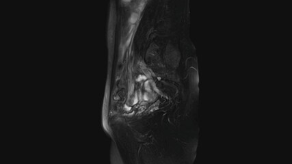MRI of the female pelvic organs, abdominal cavity, gastrointestinal tract and bladder