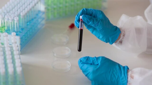 Laboratory. The doctor takes a test tube with a blood sample from the holder and examines it.