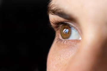 Macro eye photo. Keratoconus 3 degree - eye disease, thinning of the cornea in the form of a cone....