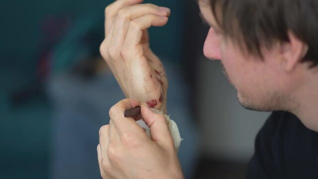 Man cleaning a bleeding wound under the skin after the accident.Traumatic pain of a hand. Treatment and disinfection of deep wounds.