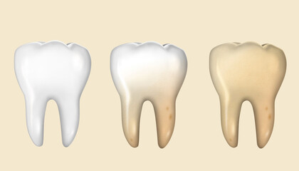 Teeth mock-up set