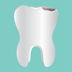 cracked tooth