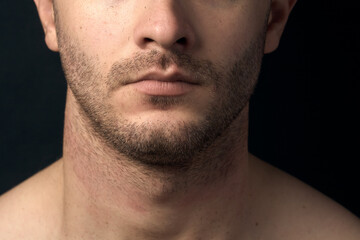 Bristle, male chin close-up. Untidy unshaven.
