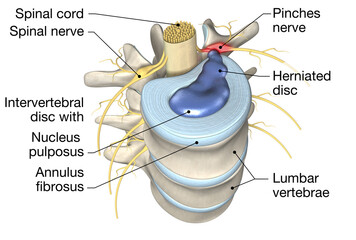 Lumbar vertebra with intervertebral disc, medically 3D illustration