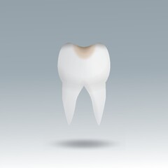 molar tooth cavity