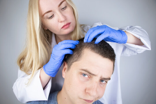 A trichologist examines the hair of a man who begins alopecia. Consultation with a dermatologist. Hair loss, alopecia, pruritus, burning head or seborrhea