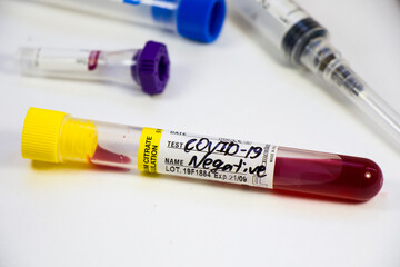 Corona virus negative test samples. Diagnosis and laboratory. Studio shoot, white background.