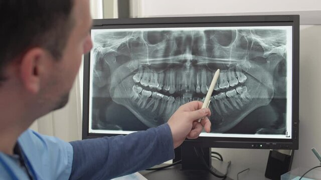 Back view of middle-aged male dentist wearing medical overall sitting at desk in front of computer monitor and examining x-ray image of jaw with the help of unrecognizable colleague