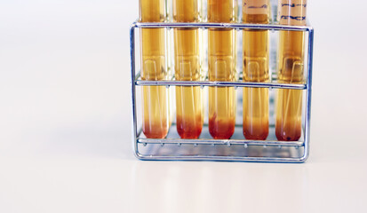 Microbiology analysis E.Coli in food sample use Most Probable number (MPN) technique for testing...