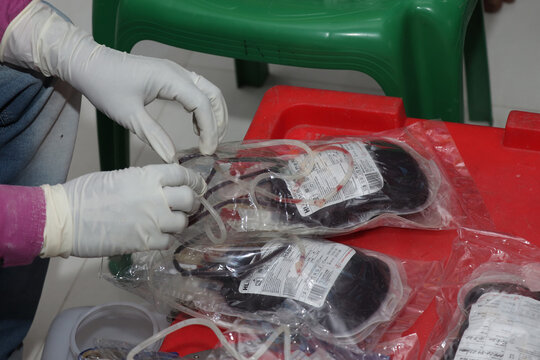 donated blood pouch stock photo