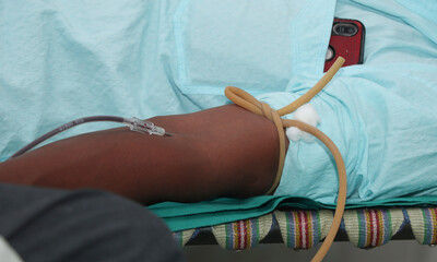 Man gives blood donation with needle in his arm