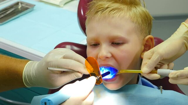 Health concept. Boy at dental clinic gets dental treatment to fill a cavity in tooth. Dental restoration and material polymerization with UV light. 4 k video