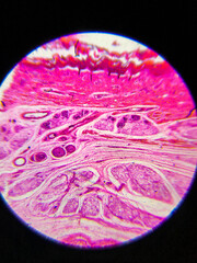 
medical preparations under a microscope