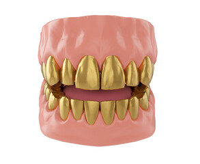 metal golden teeth in the jaw, golden crown of a teeth, 3d render