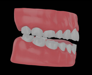 human jaw with straight teeth, correct bite, 3d render
